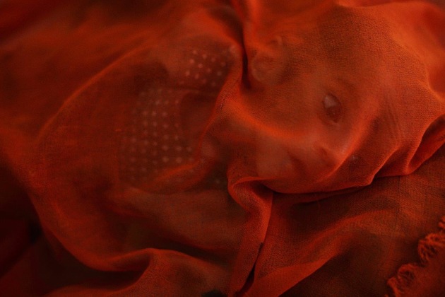 Gul Ahmad, an infant boy suffering from acute malnutrition, is covered by his mother’s scarf while being treated in the therapeutic feeding centre ward at Boost Hospital, Af-ghanistan. © Andrew Quilty.