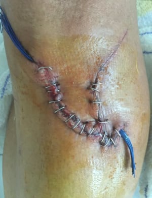 More Pro Racer Complaints Potentially Slowing the Approval of Disc Brakes