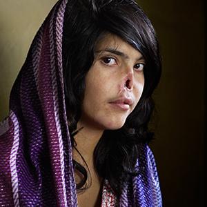 World Press Photo of the Year 2010: Bibi Aisha, 18, who was disfigured as retribution for fleeing her husband's house in Oruzgan province, Afghanistan. Photo by Jodi Bieber, South Africa, Institute for Artist Management/Goodman Gallery for Time magazine.