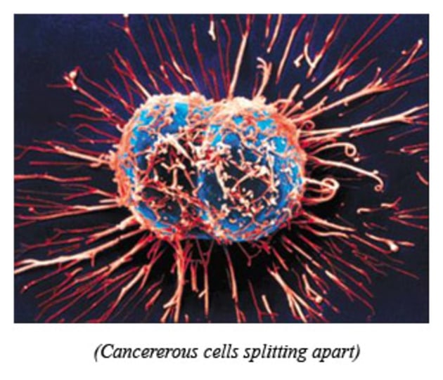 Cancerous-Cells