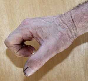 Getting the Best Grip