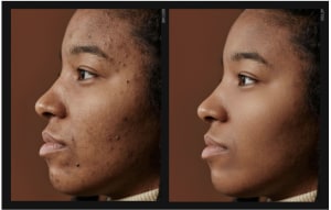 Retouch4me: smart, simple, and professional retouching for everyone